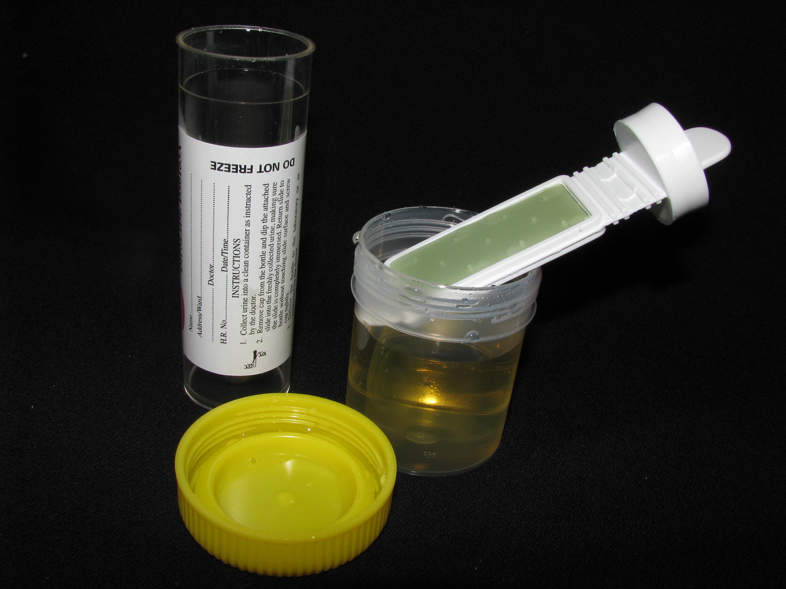NC00305 (6748) Urine Dipslides